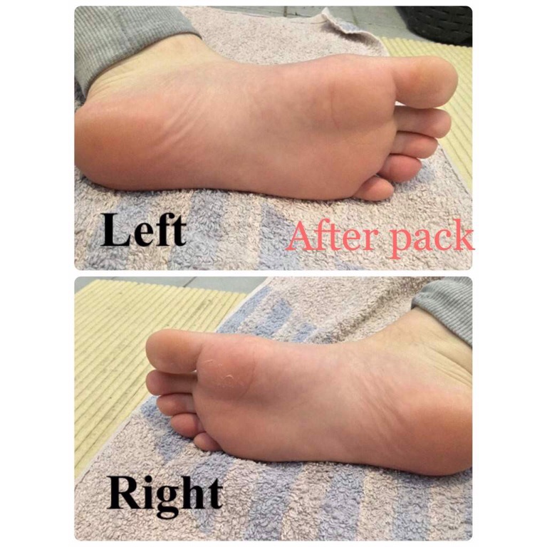Túi Ủ Tẩy Tế Bào Chết Da Chân TO PLAN Lavender Foot Care Pack Của Nhật