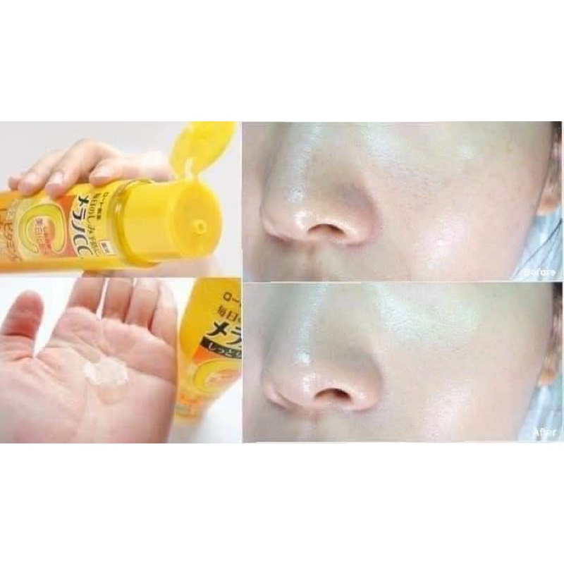 NƯỚC HOA HỒNG CC MELANO 170ml Nhật bản