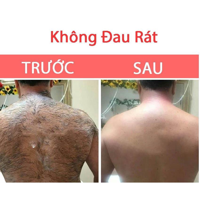 Kem Tẩy Lông Perfect Clean Huyền Phi 120ml + Serum triệt lông 20ml loại bỏ mọi loại lông không đau rát