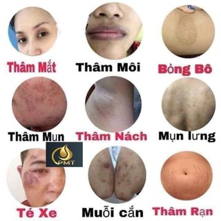 SERUM MỜ THÂM ĐA NĂNG PHÚC MINH TÂM [Chuẩn Hàng công ty]