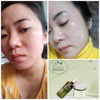 Sâm tái tạo đông y Hạnh Sinoo