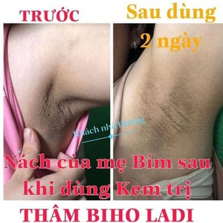 Siêu dưỡng thâm biholadi5s