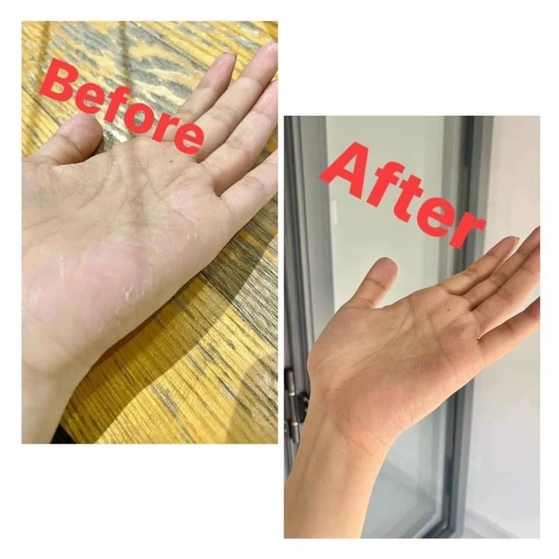 BODY OIL 4% BHA NÂNG CẤP