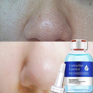 Serum xanh se lỗ chân lông cấp nước cho da