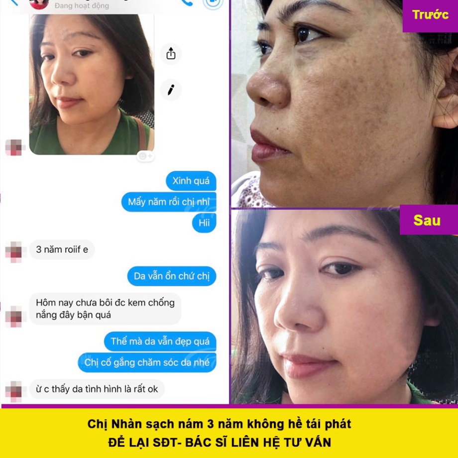 Combo kem nám, tàn nhang, đồi mồi và kem dưỡng trắng đông y gia truyền Phạm Nguyễn