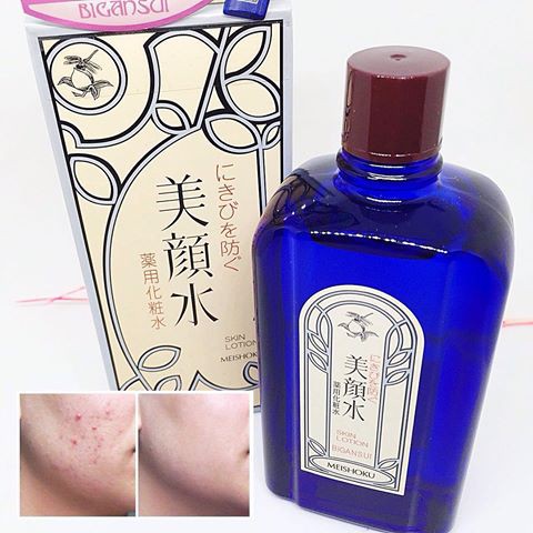 Nước hoa hồng Lotion Meishoku Bigansui Medicated giúp ngăn ngừa và giảm mụn 90ml Nhật Bản