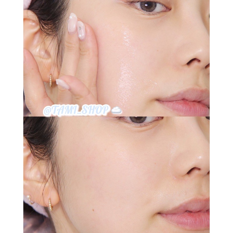 Tinh Chất Skin1004 Madagascar Centella Hyalu Cica Blue Serum
