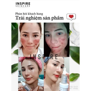 Serum INSPIRE trái cây phục hồi da