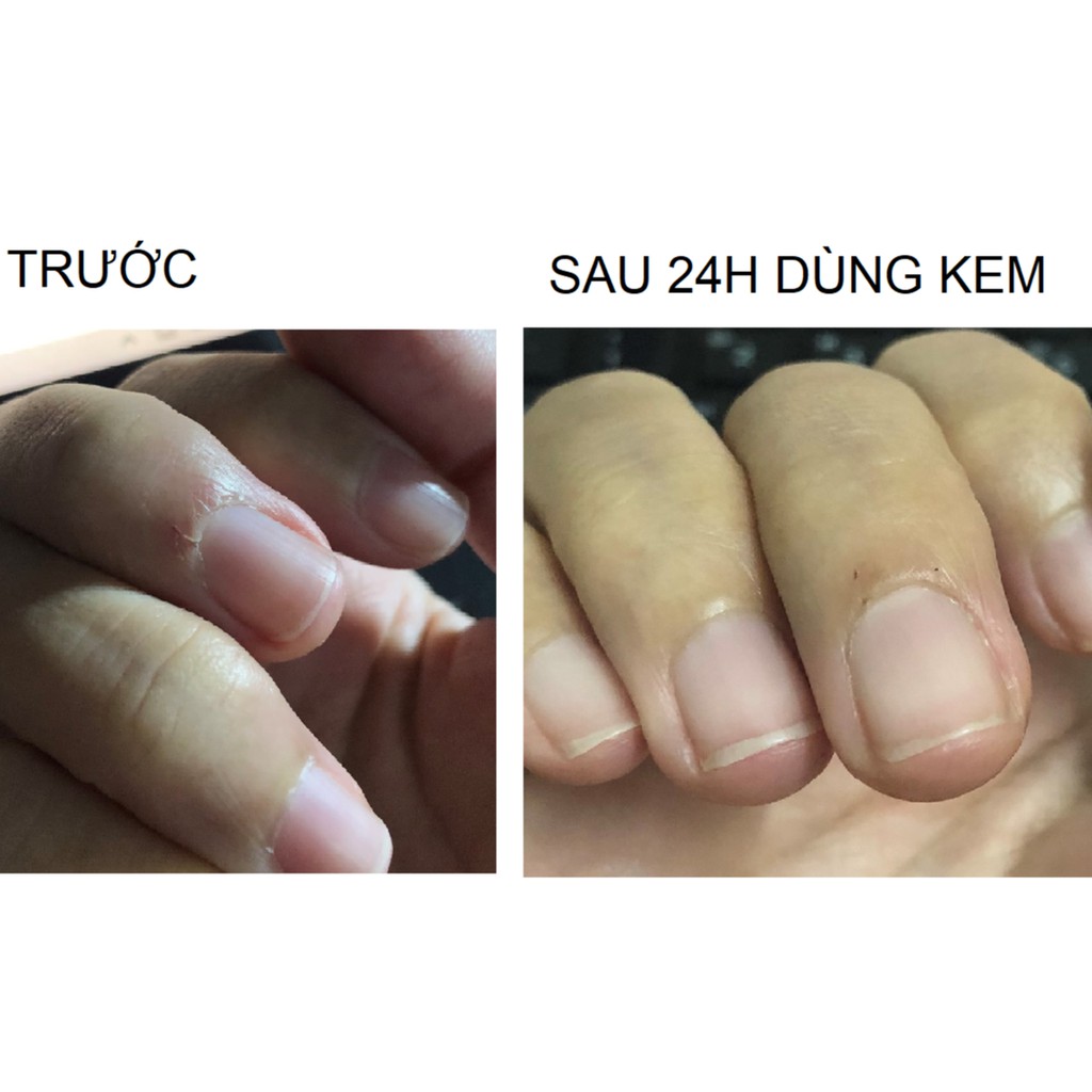 Kem Dưỡng Tay Trắng Da Thơm Lâu Chống Khô Cindynal 30g | BigBuy360 - bigbuy360.vn