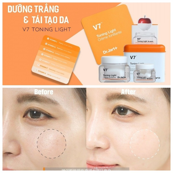 Kem dưỡng trắng phục hồi da bị hư tổn sạm nám thâm V7 TONING LIGHT Hàn Quốc [MẪU MỚI] | BigBuy360 - bigbuy360.vn