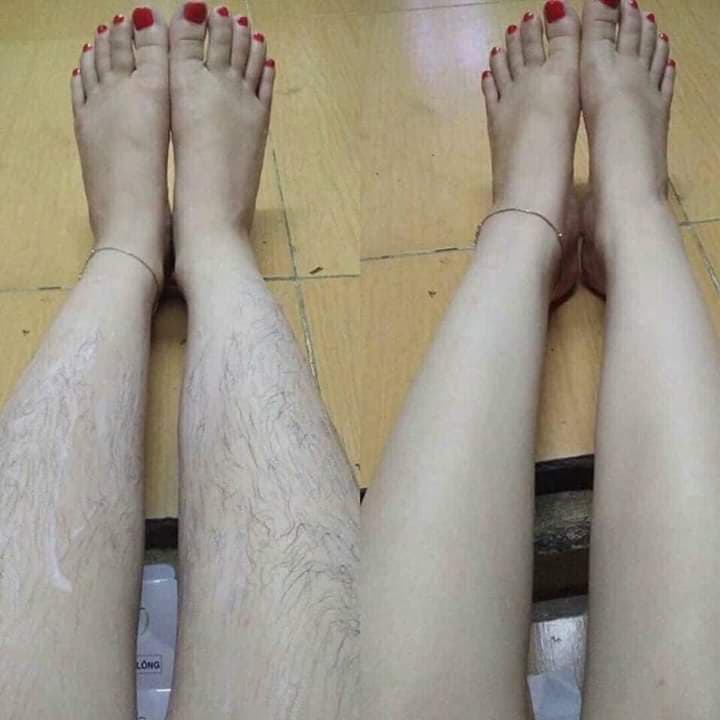 Kem triệt râu lông vĩnh viễn Mamen shop