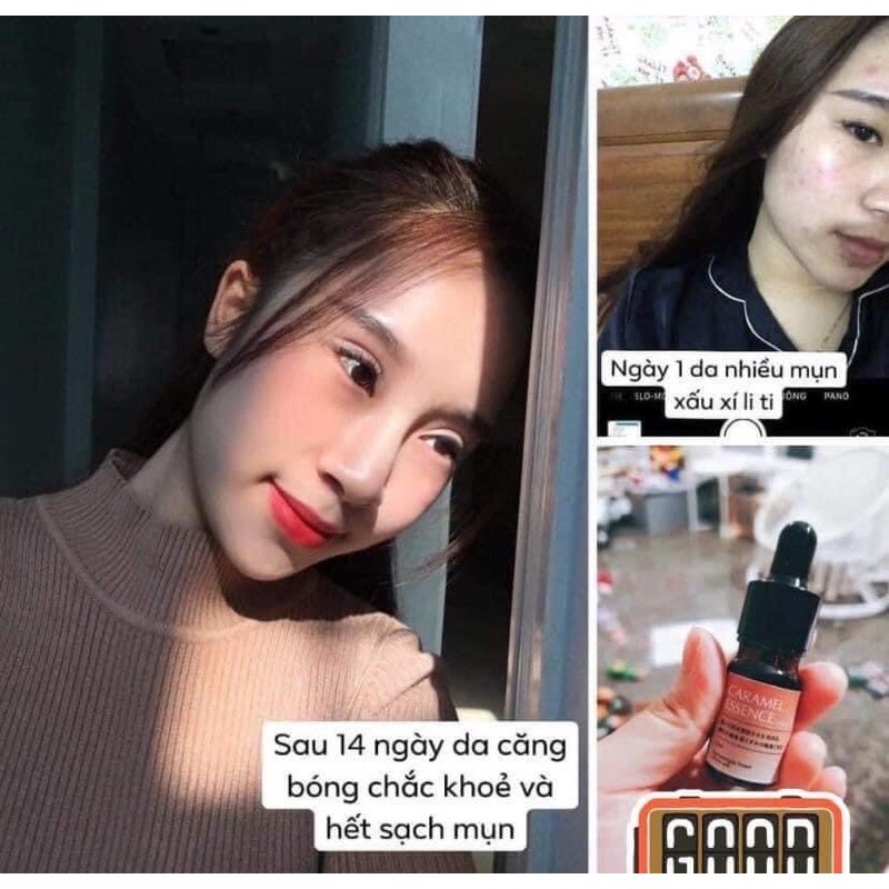 [HÀNG NHẬP KHẨU]  Serum CARAMEL ESSENCE 5ml ( được tặng thêm mặt nạ cừu) | BigBuy360 - bigbuy360.vn