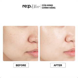 Mặt Nạ Đất Sét RE:P Bio Fresh Mask 130g