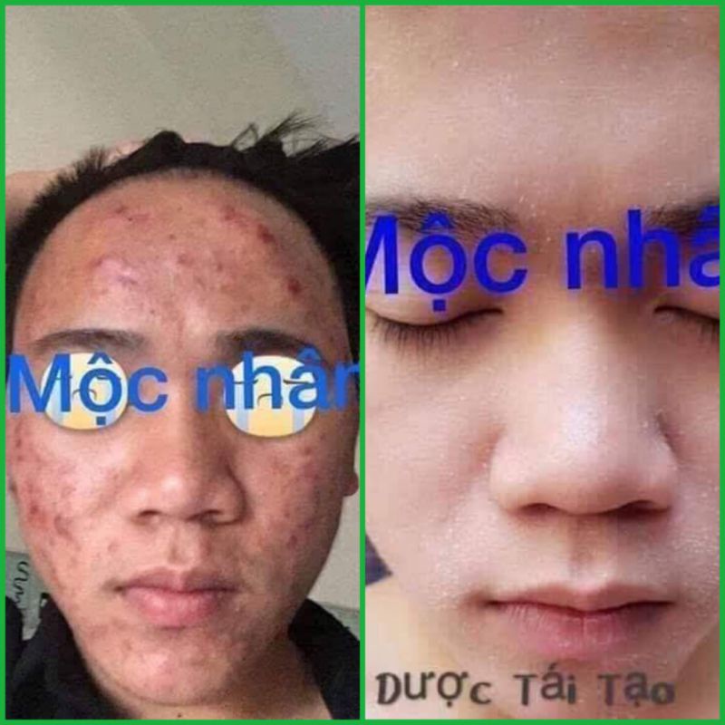 Đông Y Mộc Nhân Tái Tạo Da Thiên Nhiên Lọ 100ml