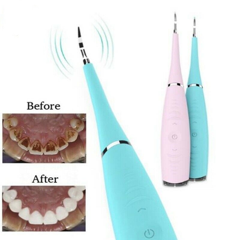 Máy Lấy Cao Răng Cầm Tay Mini Dental Flutter Sử Dụng Sạc 3 Chế Độ Rung Loại Sạch Mảng Bám, Cao Răng,Vết Ố Cứng Đầu Nhất