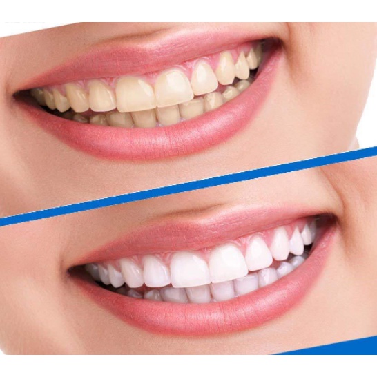 Miếng dán trắng răng 3D White Teeth Whitening Strips hàng nội địa Trung