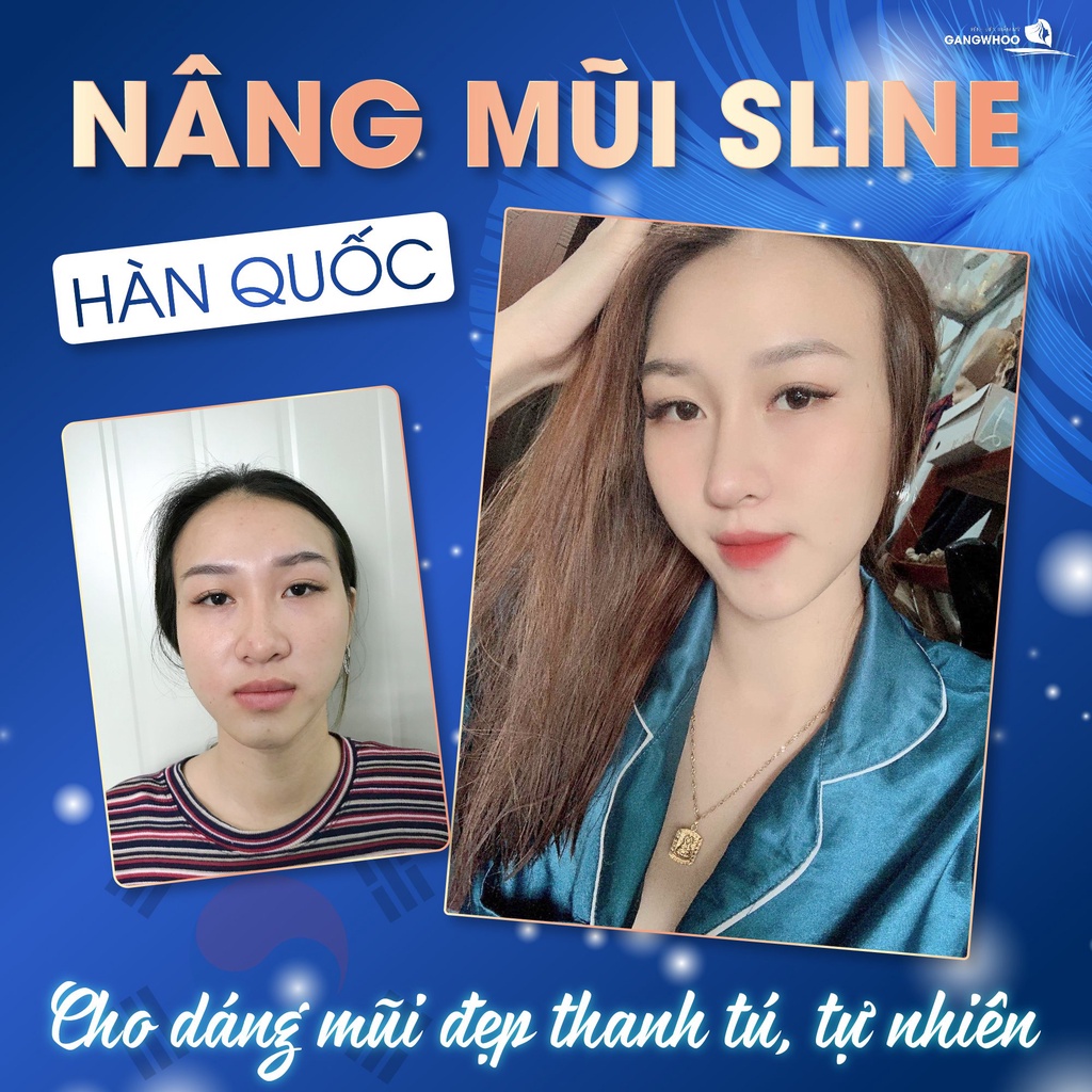 Nâng Mũi Sline-Lline