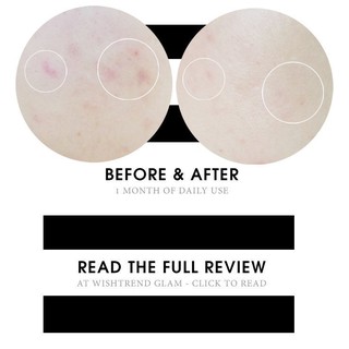 [Bill Hàn] Tinh chất Cosrx BHA Blackhead Power Liquid 100ML