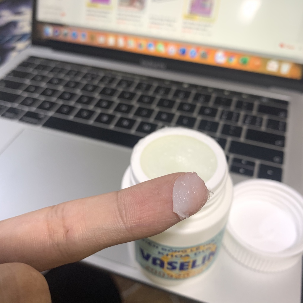 Kem Dưỡng Ẩm Vaseline viện bỏng