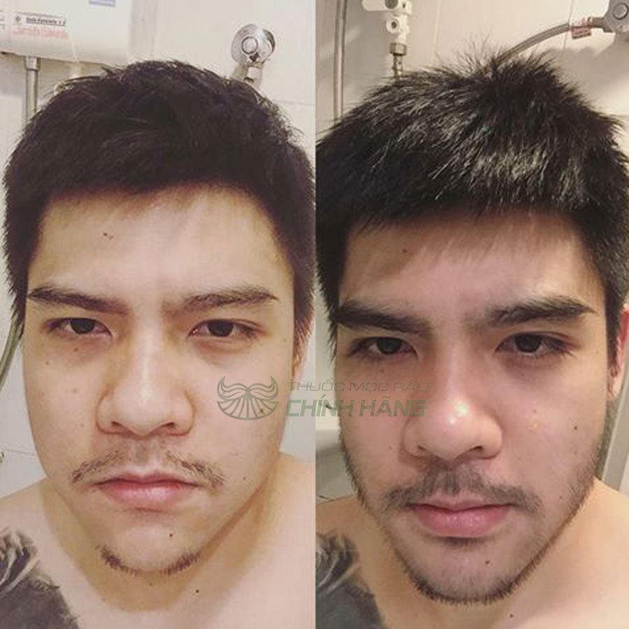 Biotin 10000 Mcg 100 Viên Của Mỹ