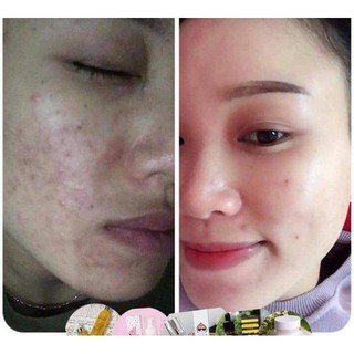 Moshroom serum KOSXU -HÀN QUỐC
