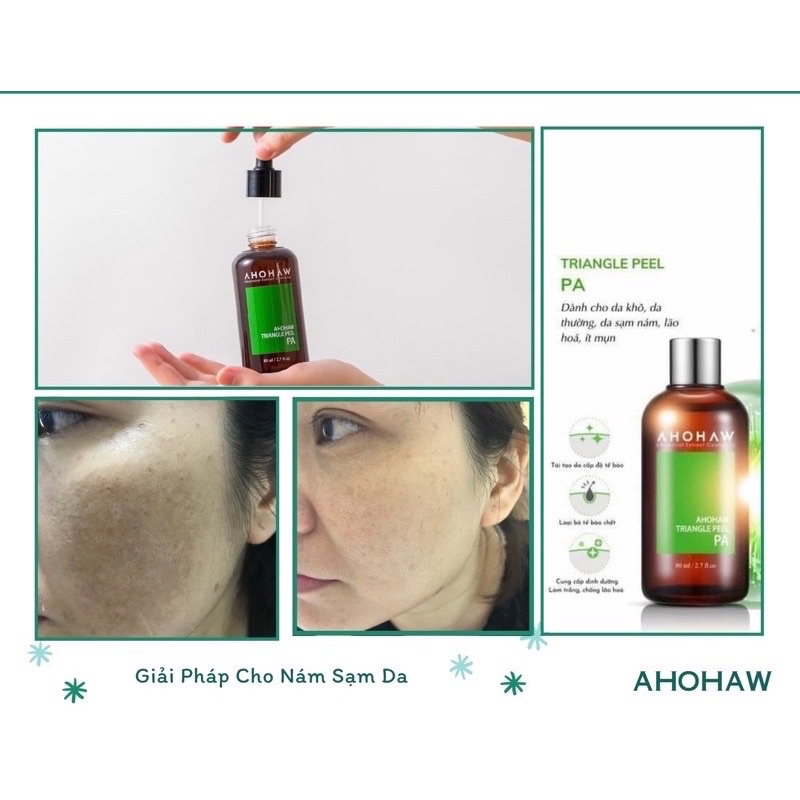 Peel  Ahohaw Triangle PB & PA, Không Bong Tróc , Không Đỏ Da 10ml