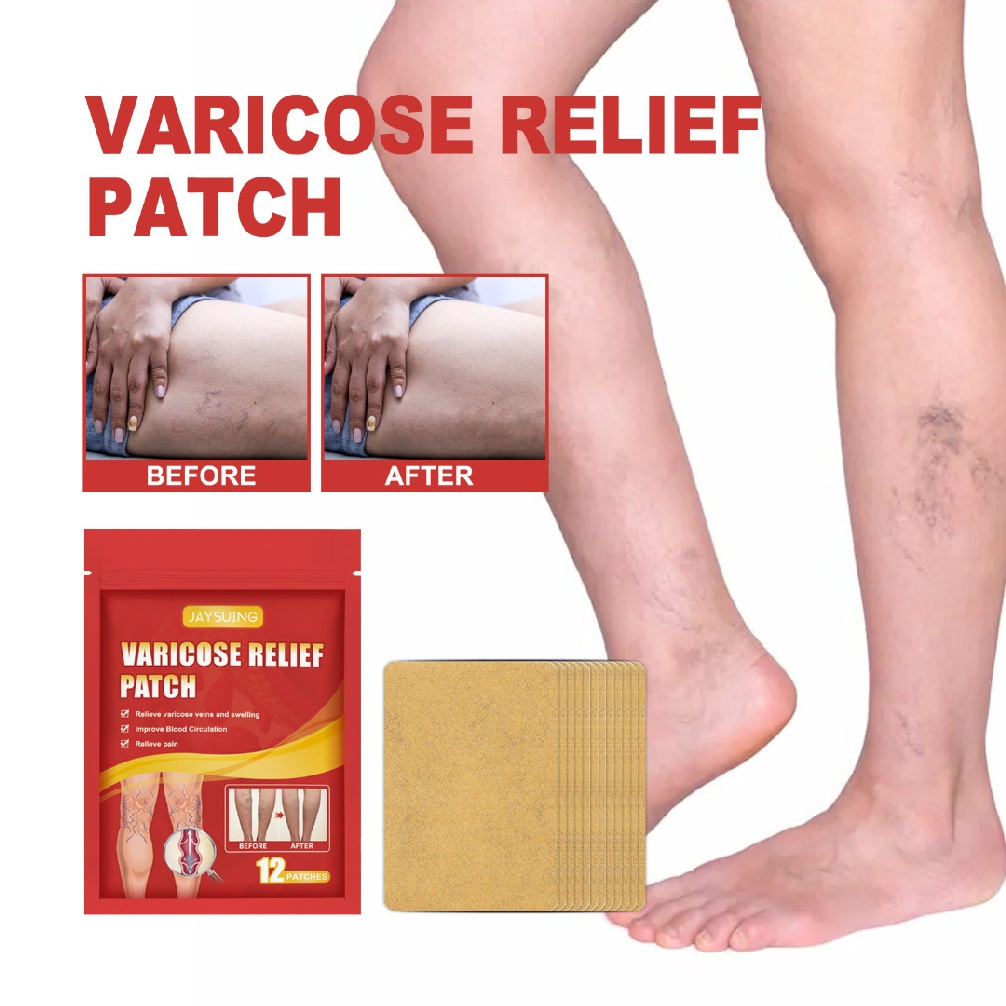 [Hàng mới về] Set 12 miếng dán giảm giãn tĩnh mạch chân nhện