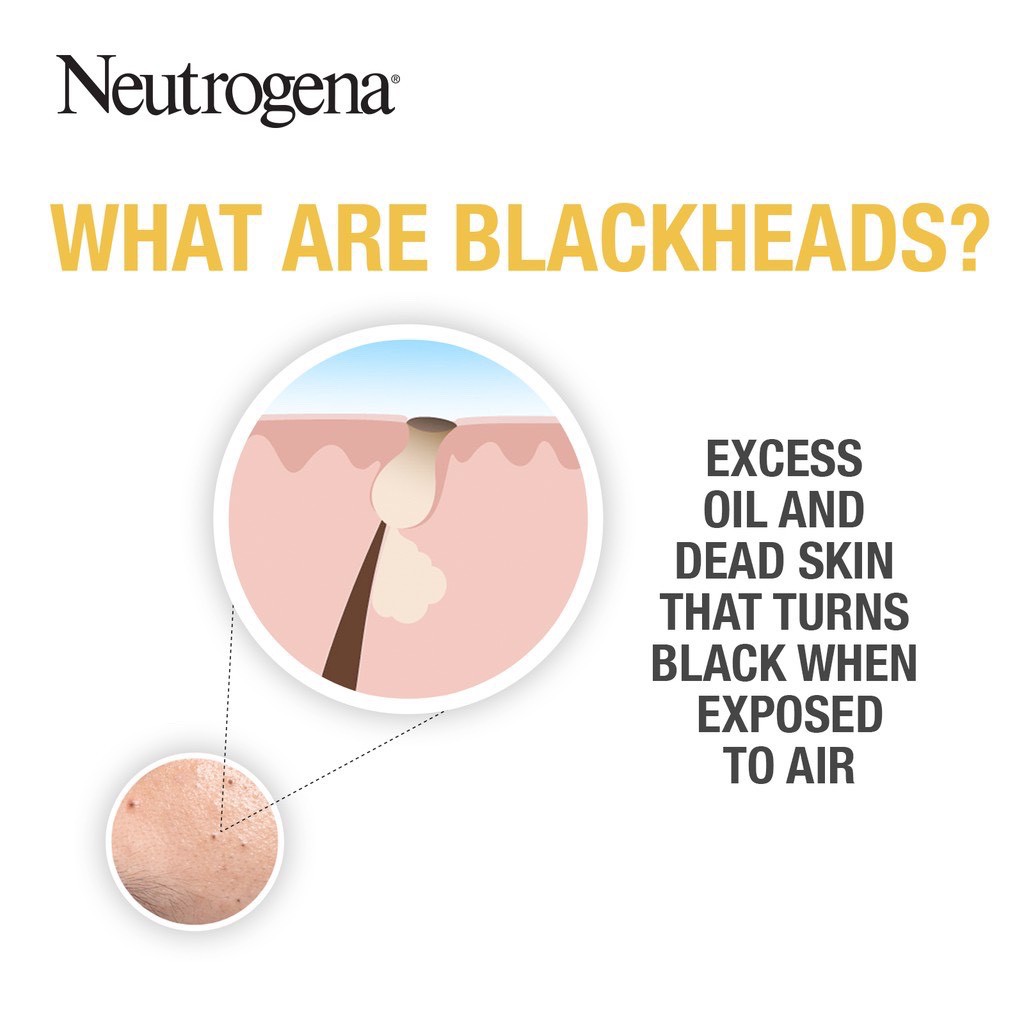Tẩy Tế Bào Chết NEUTROGENA giảm và ngăn ngừa mụn đầu đen - Blackhead Eliminating Daily Scrub 100G