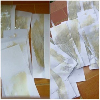 Combo triệt lông wax + mỡ trăn