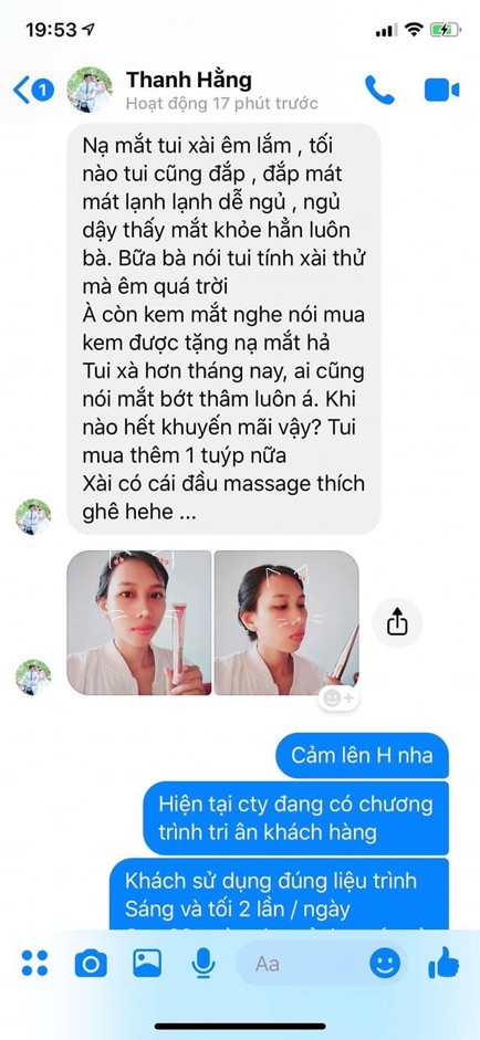 Kem trị bọng mắt, thâm quầng mắt Hanco