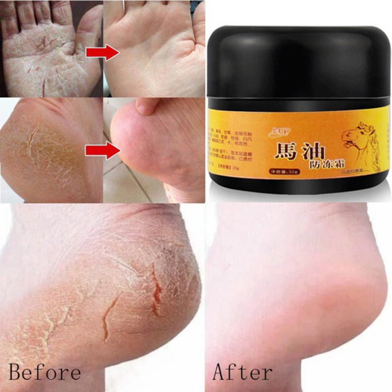 Kem bôi nứt gót chân con ngựa hàng nội địa trung