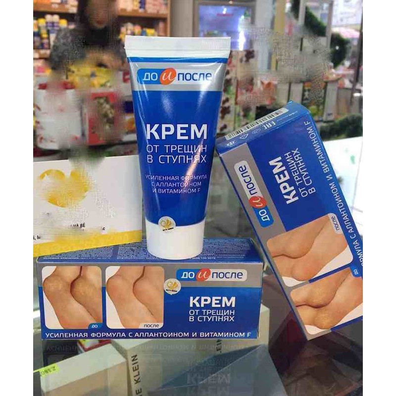 Kem Ngăn Ngừa Và Hồi Phục Nứt Nẻ Gót Chân Kpem Nga 50ml