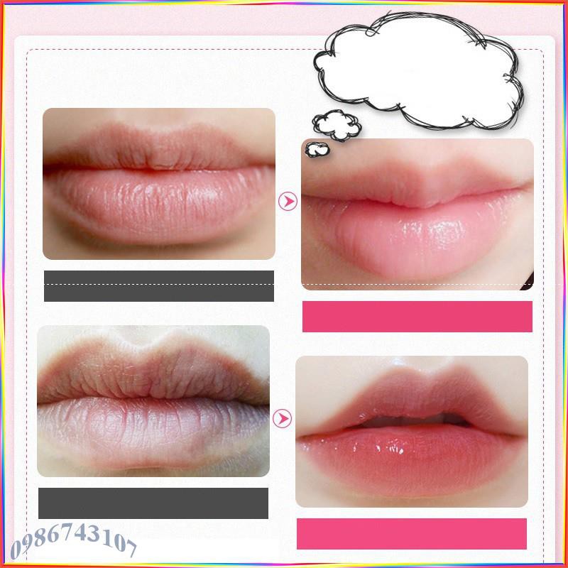 Mặt nạ dưỡng môi nội địa Trung nhiều hãng ANE4 | BigBuy360 - bigbuy360.vn