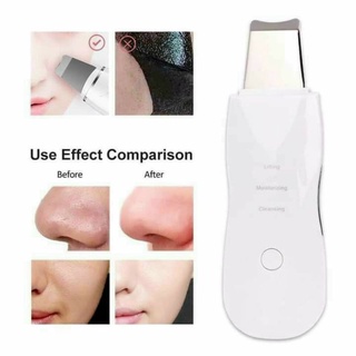 Máy massage mặt, làm sạch da mặt