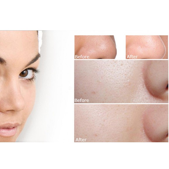 Gel tẩy da chết dưỡng ẩm và làm sáng da Edally Hàn Quốc - Smoothing Peeling Gel 120ml