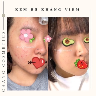KEM PHỤC HỒI DA B5