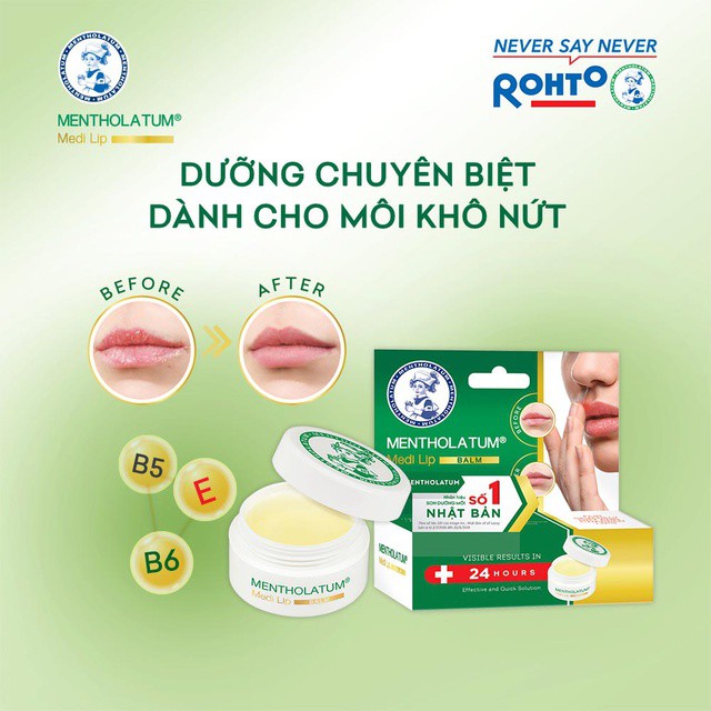 [Mã FMCGMALL giảm 8% đơn từ 250K] Son Dưỡng Mentholatum Medi Lip Balm Dành Cho Môi Khô Và Nứt Nẻ 7g