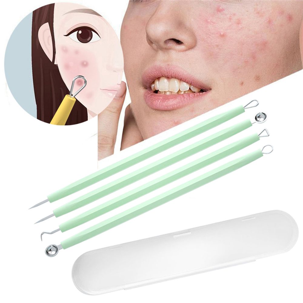 Mxbeauty Bộ Dụng Cụ Nặn Mụn Đầu Đen Bằng Thép Không Gỉ Tiện Lợi
