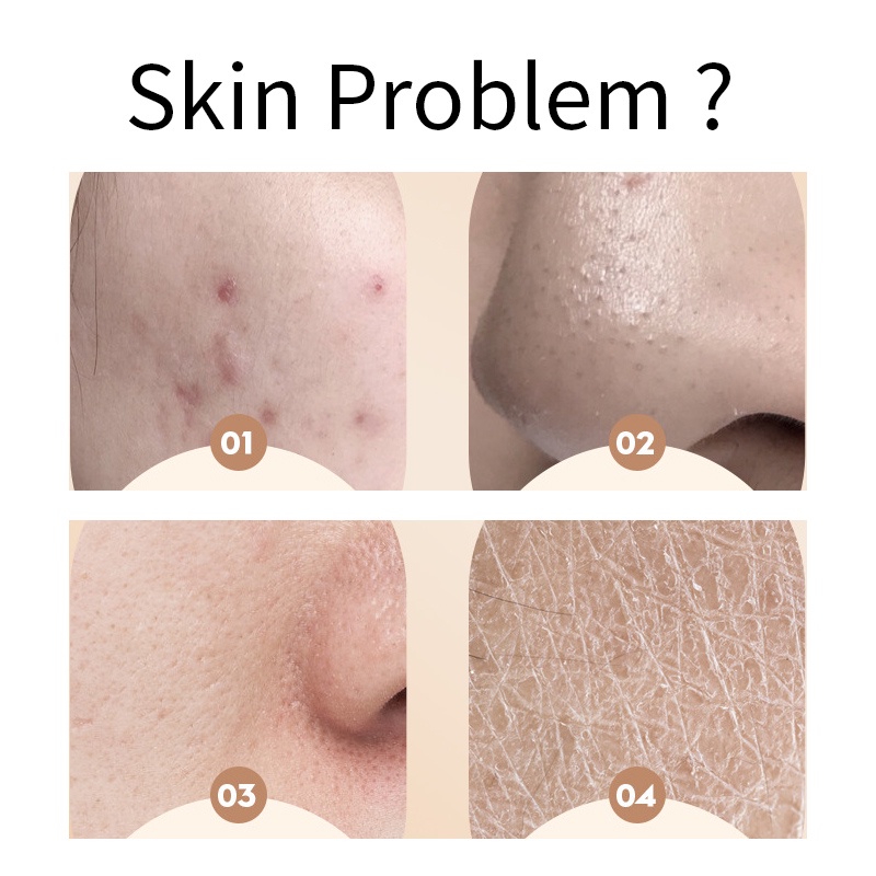 Kem dưỡng ẩm PFFEE từ dầu cừu để chăm sóc da mặt da tay và cơ thể