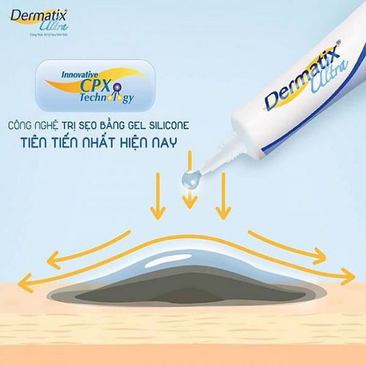 Kem mờ sẹo Dermatix Ultra nhập khẩu USA - làm phẳng và mờ sẹo lồi, sẹo thâm, sẹo phì đại, nám rạn da