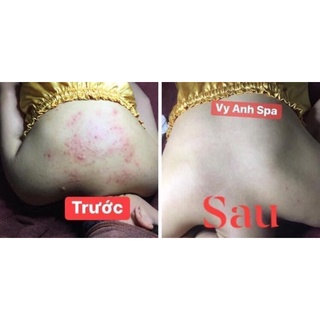 Noãn thực vật .