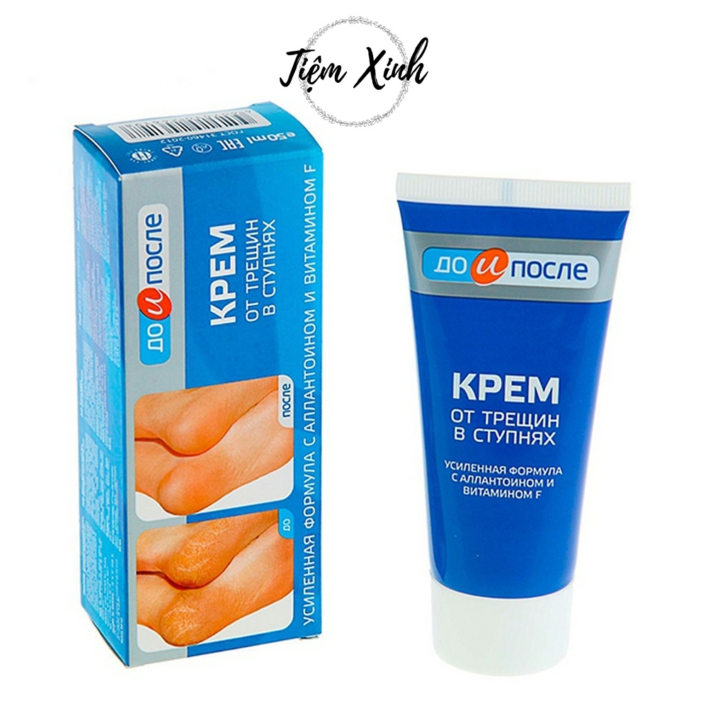 Kem nứt gót chân Kpem Apteka Nga 50ml kem dưỡng da chân, nẻ gót chân, dưỡng da chân mềm mịn