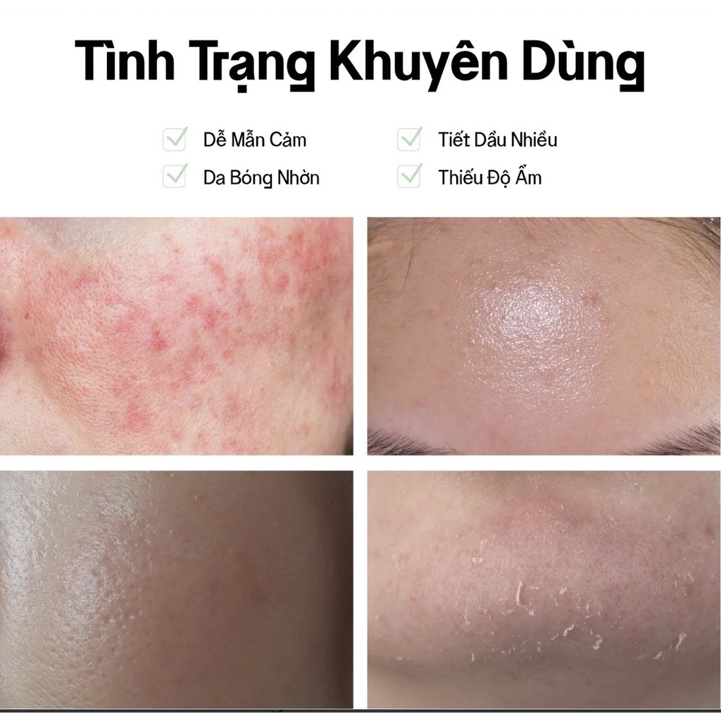 Kem Dưỡng Ẩm Thuần Chay Cho Da Dầu Nhạy Cảm Vegick Superfood + B5 Moisture Cream 50ml