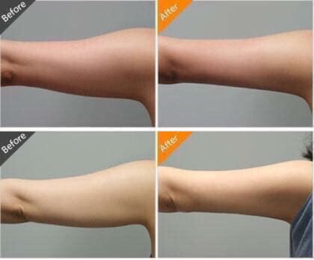 Soap Xà Phòng Cam Mụn Trứng Cá GALONG Herbal 60g - Thái Lan | BigBuy360 - bigbuy360.vn