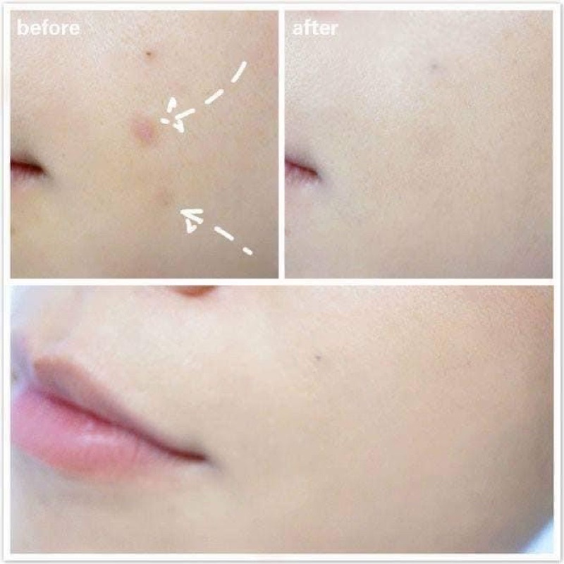 Che khuyết điểm Makeup Forever full cover