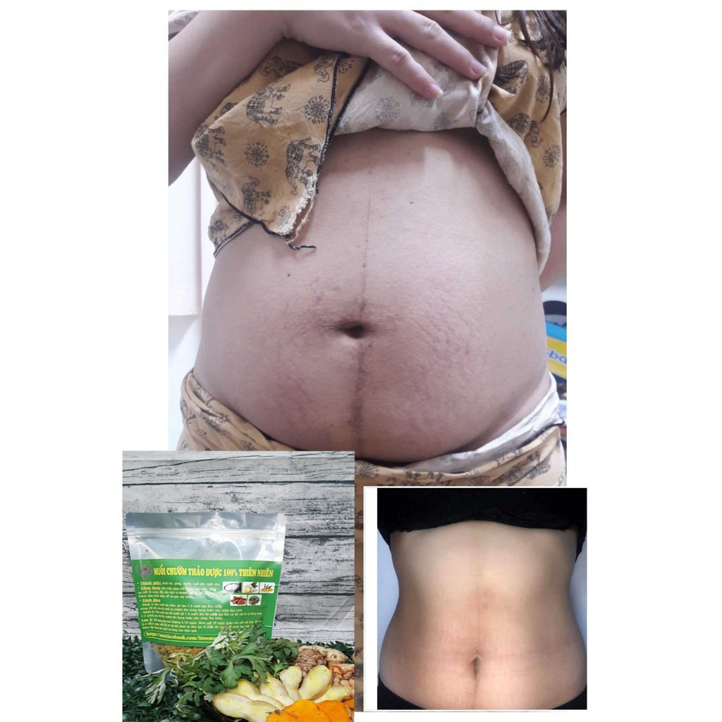 Combo 3 Túi Muối 500g Chườm Bụng Thảo Dược Sau Sinh [Tặng Đai Vải Chườm và 1 lọ cốt Nghệ Gấc Hạ Thổ]