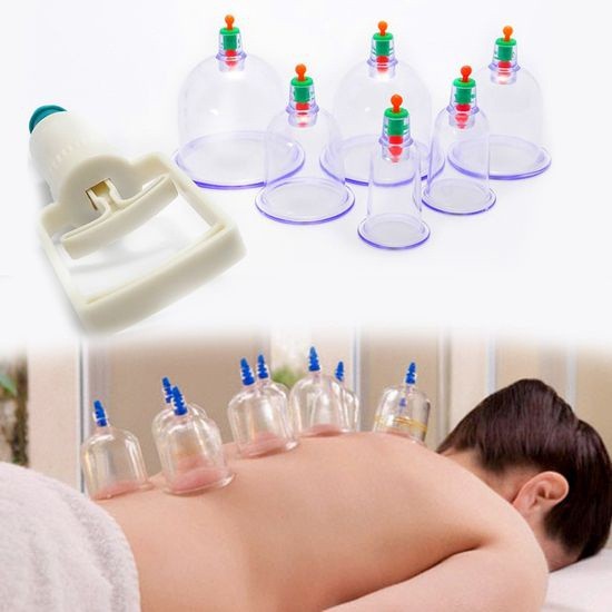 Bộ Giác Hơi Không Dùng Lửa 12 Món