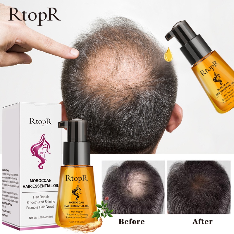 RtopR bộ chăm sóc tóc：Dầu gội thảo dược RtopR 20ml + RtopR Moroccan Hair Oil 35ml