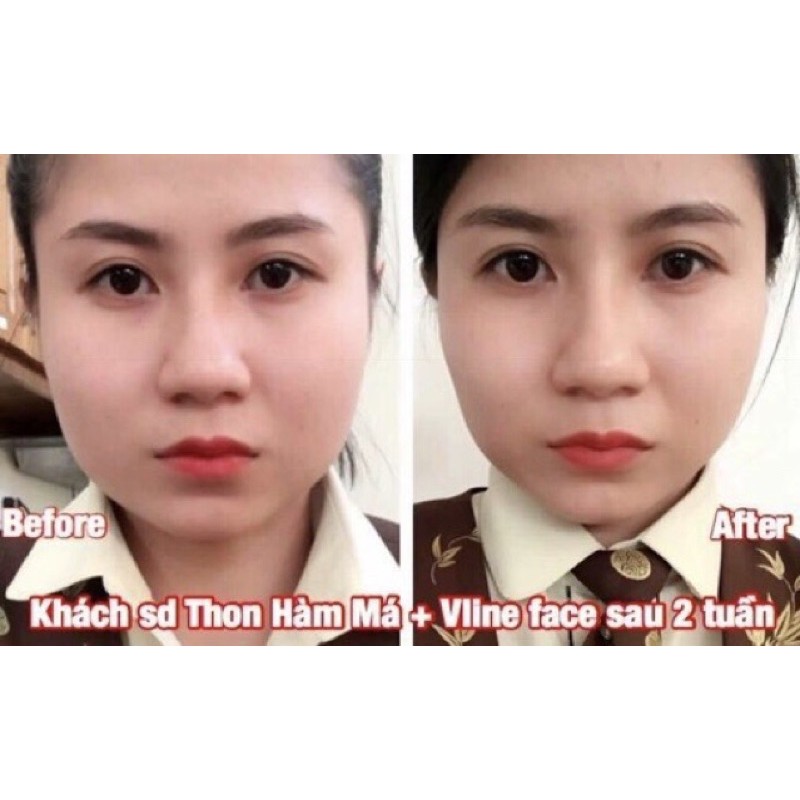 Serum tinh chất thon gọn xương, tạo mặt Vine face - Hàn Quốc (20ml)