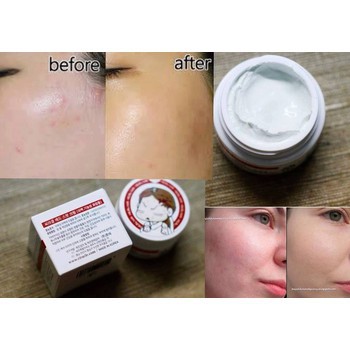 Kem Mụn Ciracle Red Spot Cream